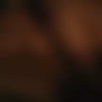 Kenbarbie