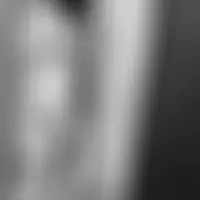 Bimes