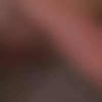 Ninalipe2025