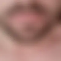 Jackobson