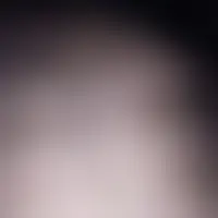 Loloperpi