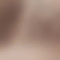 Oliveg83170