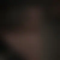 Erop