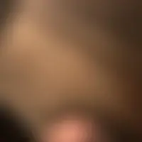 Erbalunga