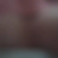 Cplbii