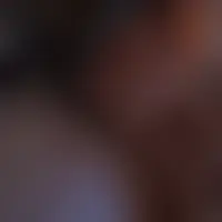 Drqni20x5