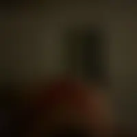 Albakarst